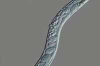 C. elegans untreated DIC 400x