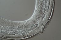 C. elegans untreated DIC 1250x